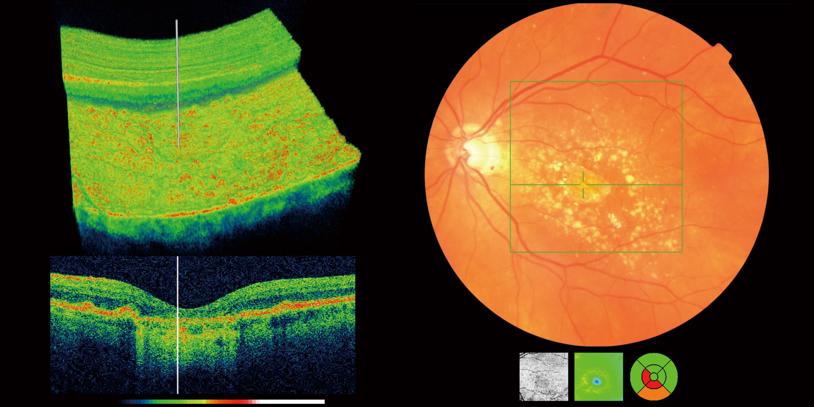 OCT Eye Scan Canterbury Kent